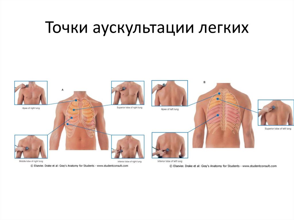 Точки аускультации легких в картинках