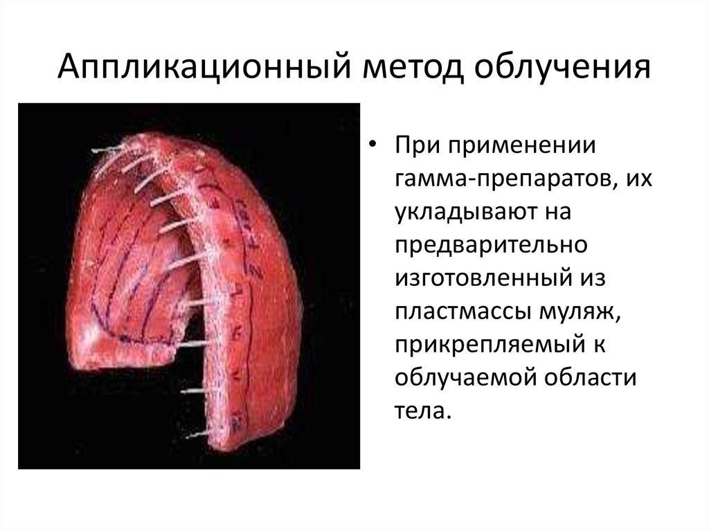 Методы лучевой терапии презентация