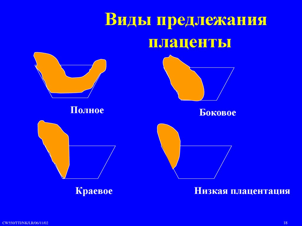 Полный боковой. Виды предлежания плаценты. Виды поедлежаний плацегты. Типы предлежания плаценты. Разновидности предлежания плаценты.