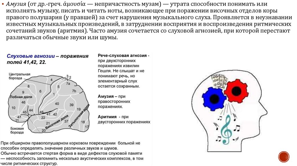 Возникнуть поражение. Амузия возникает при поражении. Амузия у правшей возникает при поражении:. Сенсорная амузия. Амузия локализация.