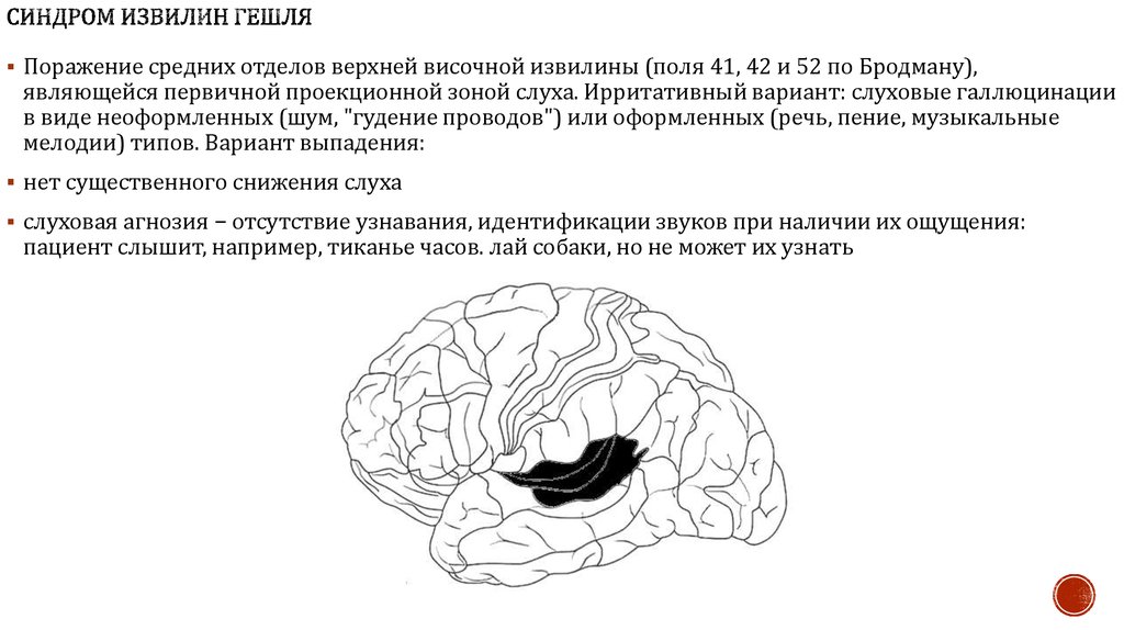 Височной извилины. Извилина Гешля височная Гешля. Поперечные височные извилины Гешля. Поперечная извилина Гешля.