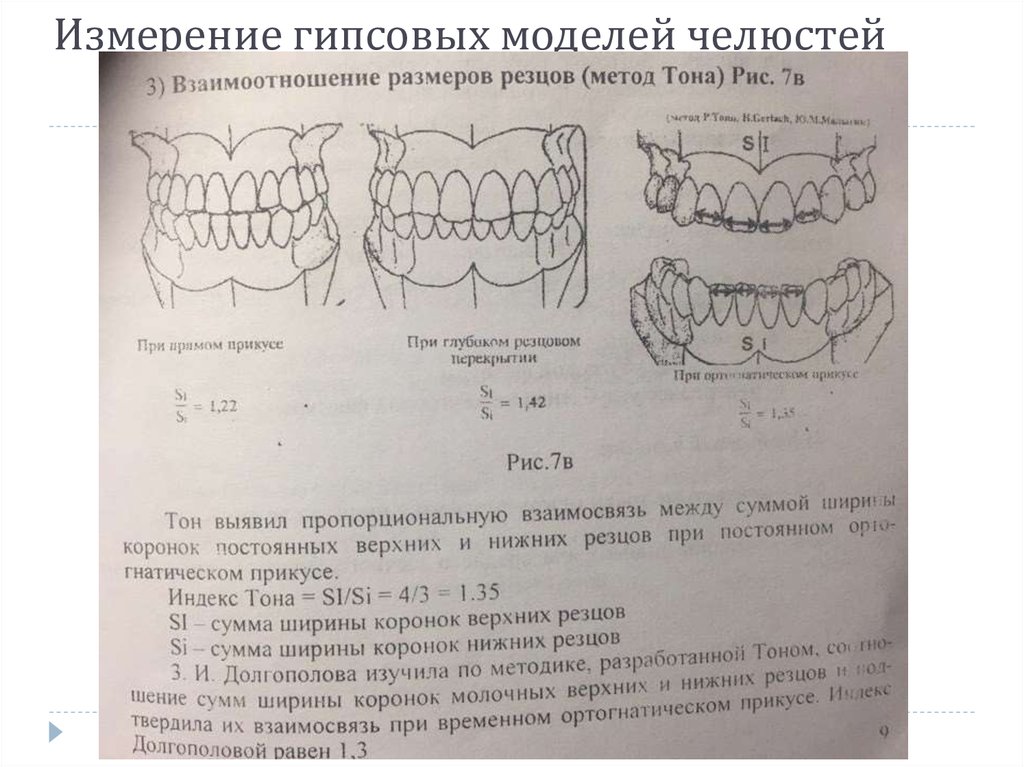 Высота нижних резцов