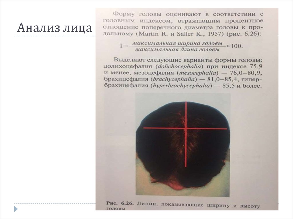 Тест головы. Анализ лица. Анализ нижней трети лица, анализ улыбки презентация.