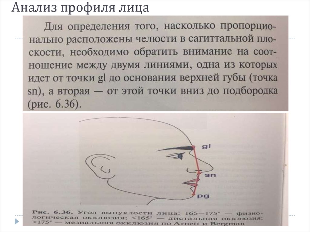 Анализ профиля. Анализ профиля лица. Угол профиля лица. Определение типа профиля лица. Анализ профиля лица точки.