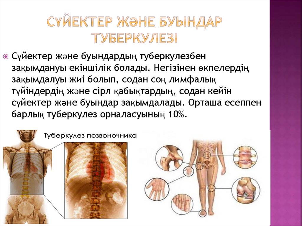 Буын синдромы презентация