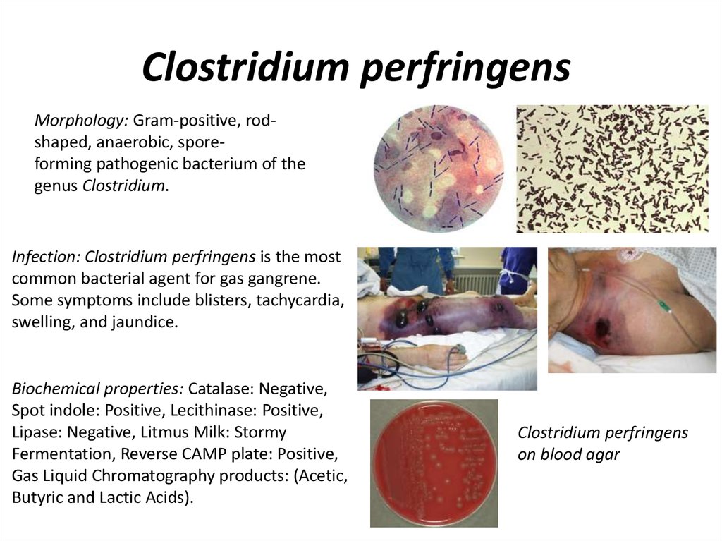 Clostridium Skin Infection