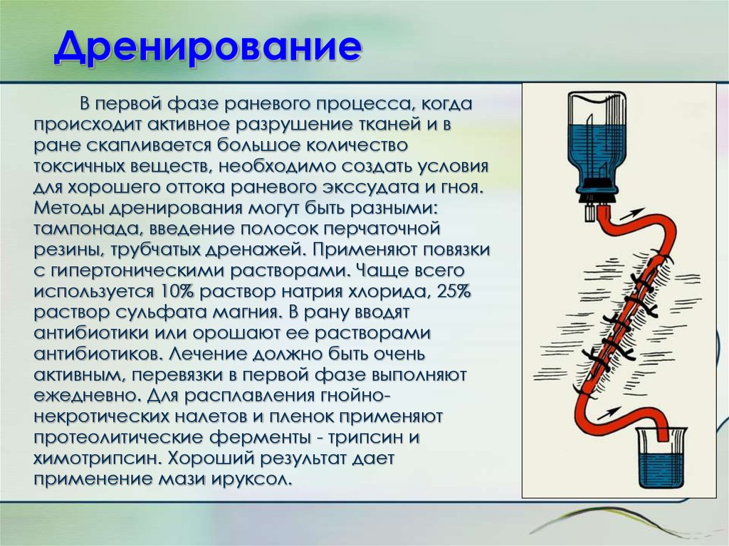 Дренаж ран. Пассивное дренирование РАН. Активное дренирование по Редону.