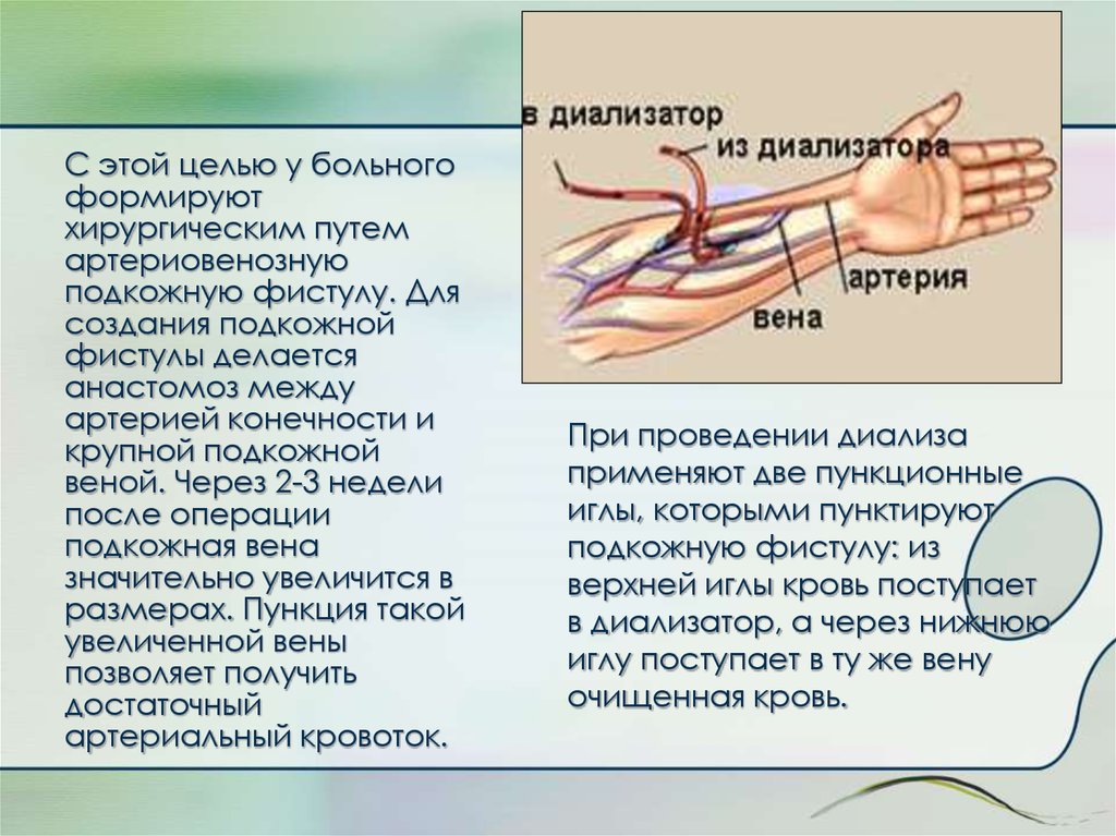 Артериовенозный шунт. Артерио-венозная фистула. Артериовенозный шунт для гемодиализа. Артерио-венозная фистула для диализа. Артерия венозная фистула.