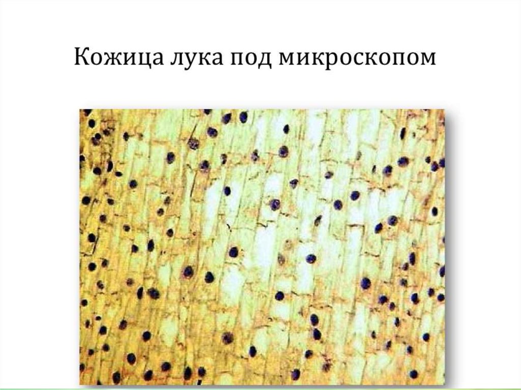 Лук под микроскопом лабораторная работа. Клетки кожицы лука под микроскопом x40. Препарат кожицы лука под микроскопом. Вид кожицы лука под микроскопом. Кожица лука под микроскопом с йодом.