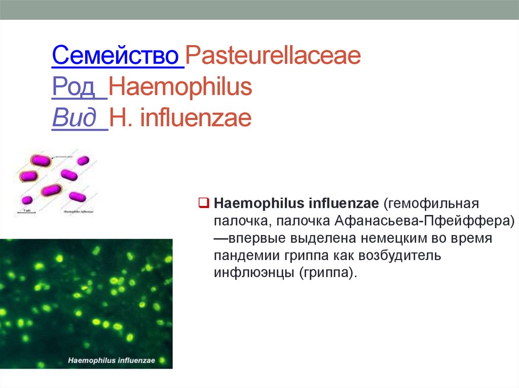 Haemophilus influenzae b. Бактерии Haemophilus influenzae. Haemophilus influenzae морфология. Гемофильная палочка микробиология. Haemophilus influenzae факторы вирулентности.