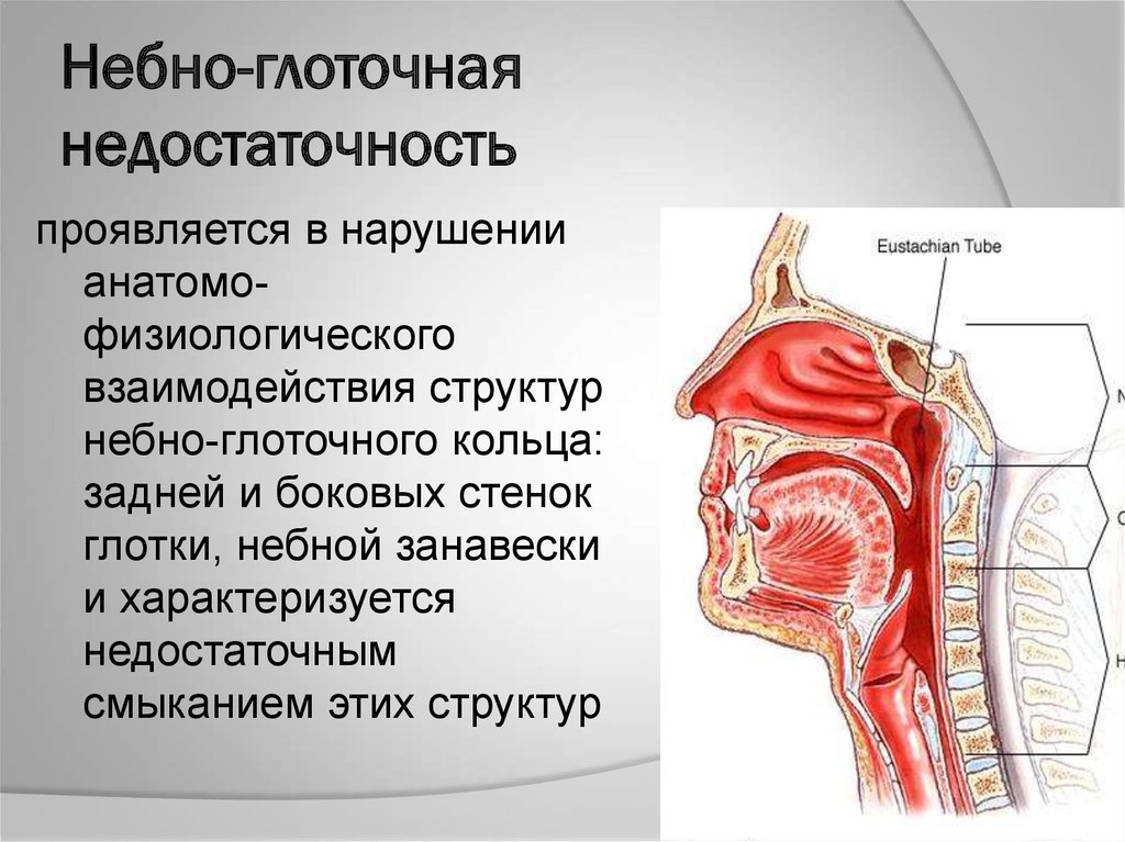 Глоточное кольцо. Носа глоточная миндалина. Небно-глоточная недостаточность. Функции небно-глоточного затвора. Небно-глоточное смыкание.