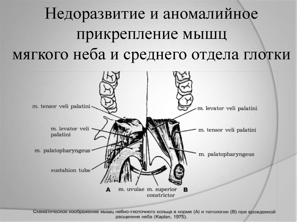 Небно глоточная мышца