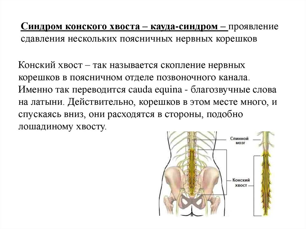 Конский хвост спинного мозга. Конский хвост позвоночника. Конский хвост нервы.