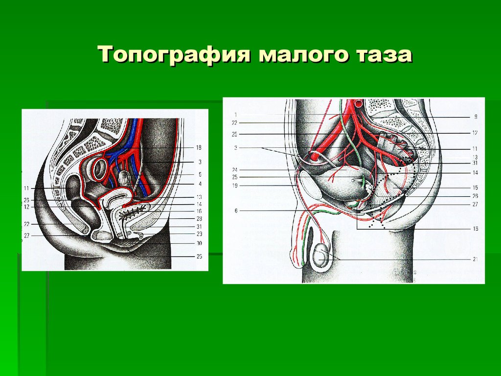 Передний наклон таза фото