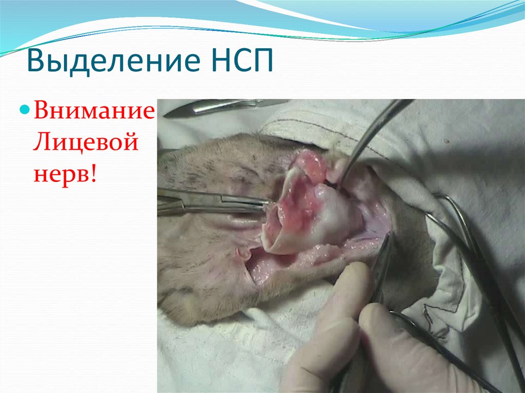 Выделение НСП