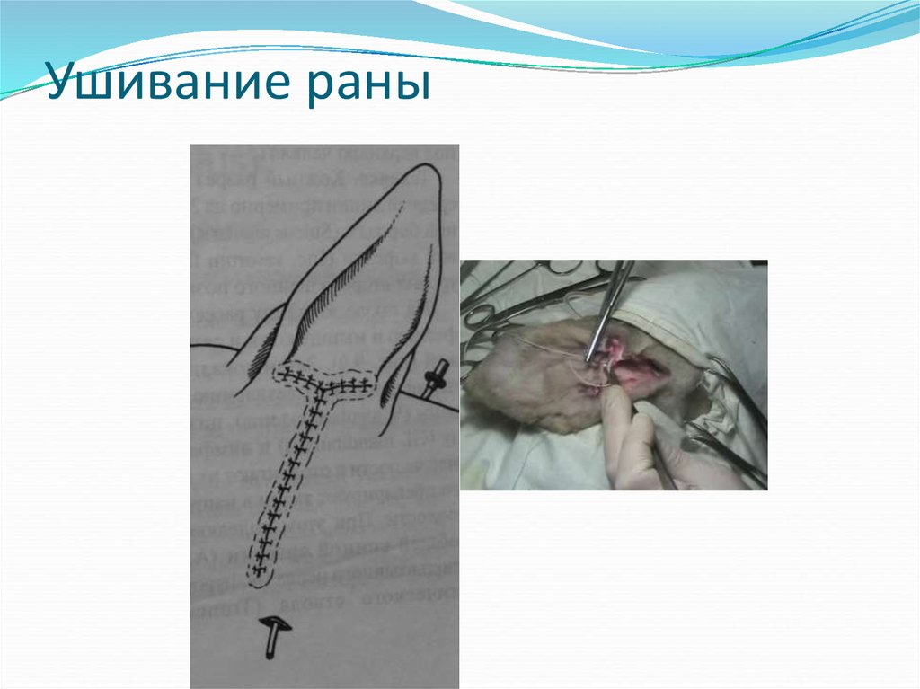 Ушивание раны
