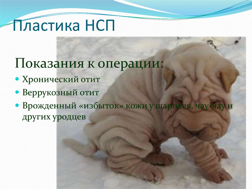 Пластика НСП