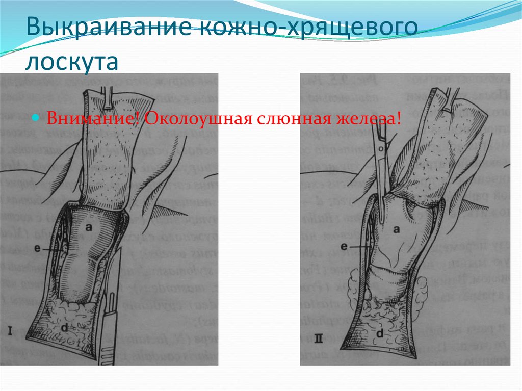 Принцип лоскута