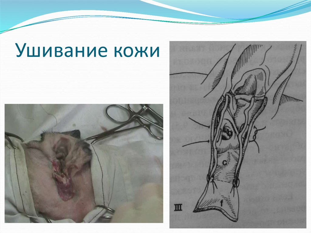 Ушивание кожи