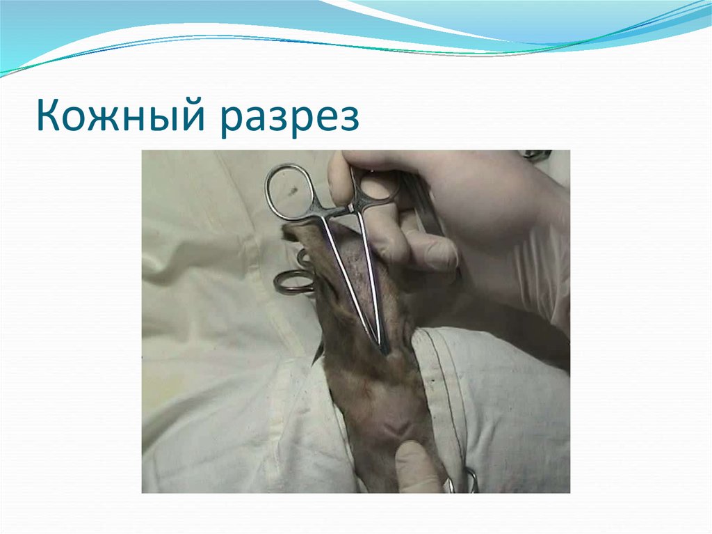 Кожный разрез