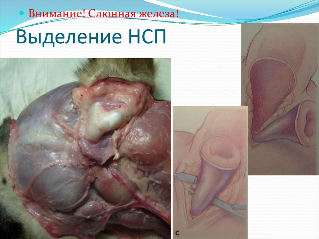 Выделение НСП