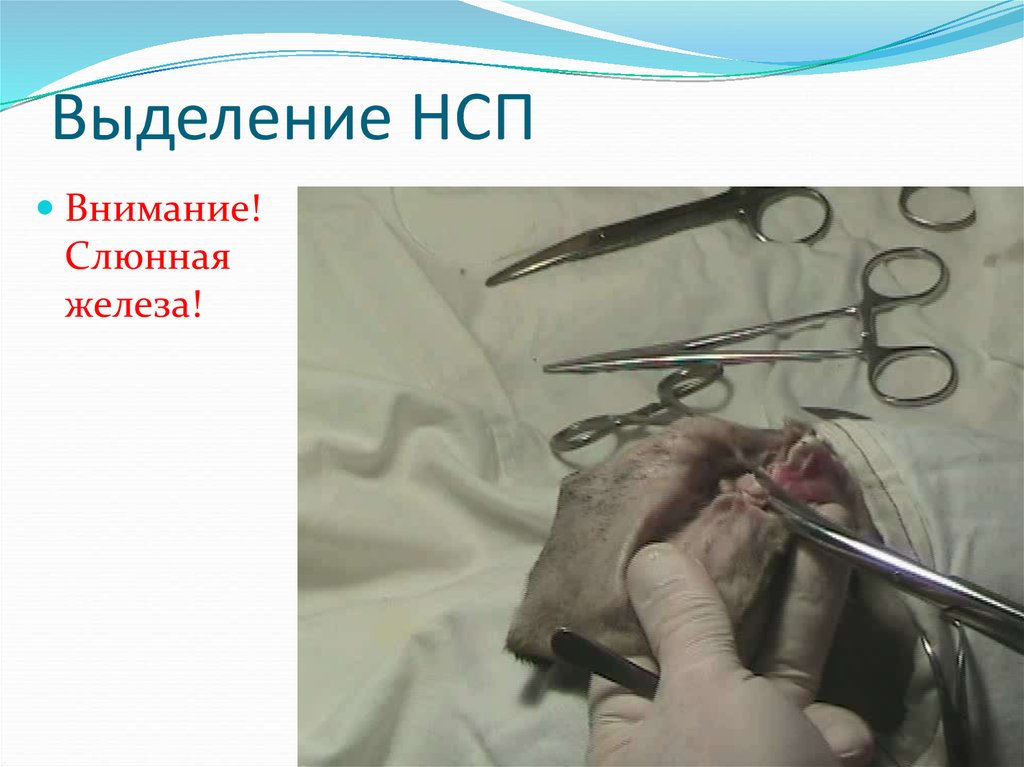 Выделение НСП