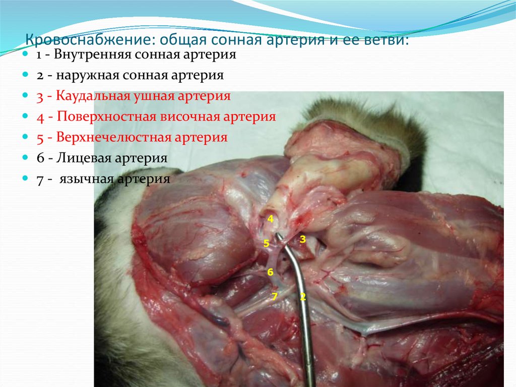 Кровоснабжение: общая сонная артерия и ее ветви: