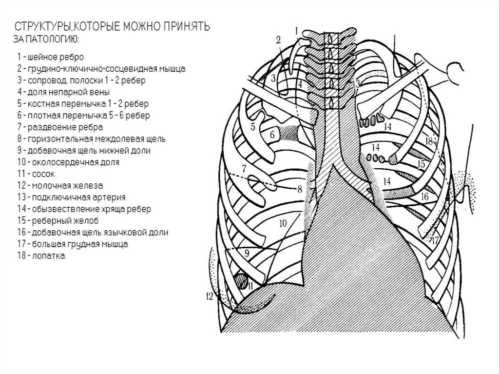 Рентгеноанатомия органов грудной полости. Схема строения грудной полости. Рентгеноанатомия грудной клетки.