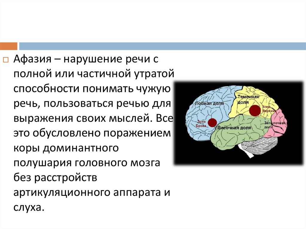 Афазия речи. Афазия мозг. Первичная прогрессирующая афазия. Первичной прогрессирующей афазии. Распространенность афазии.