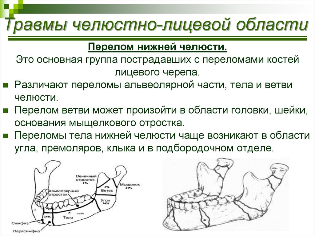 Переломы верхней и нижней челюсти презентация