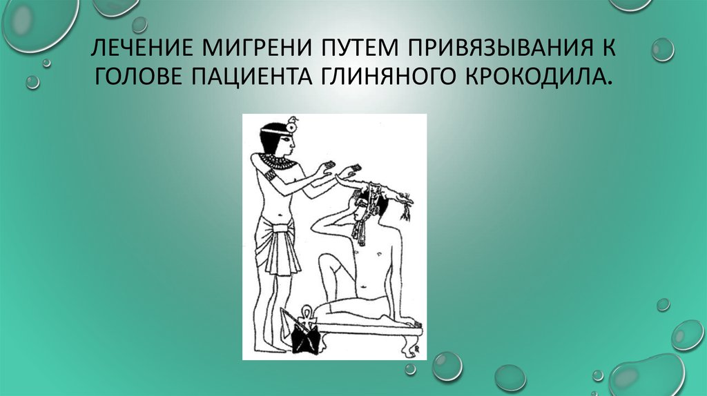Лечение мигрени путем привязывания к голове пациента глиняного крокодила.