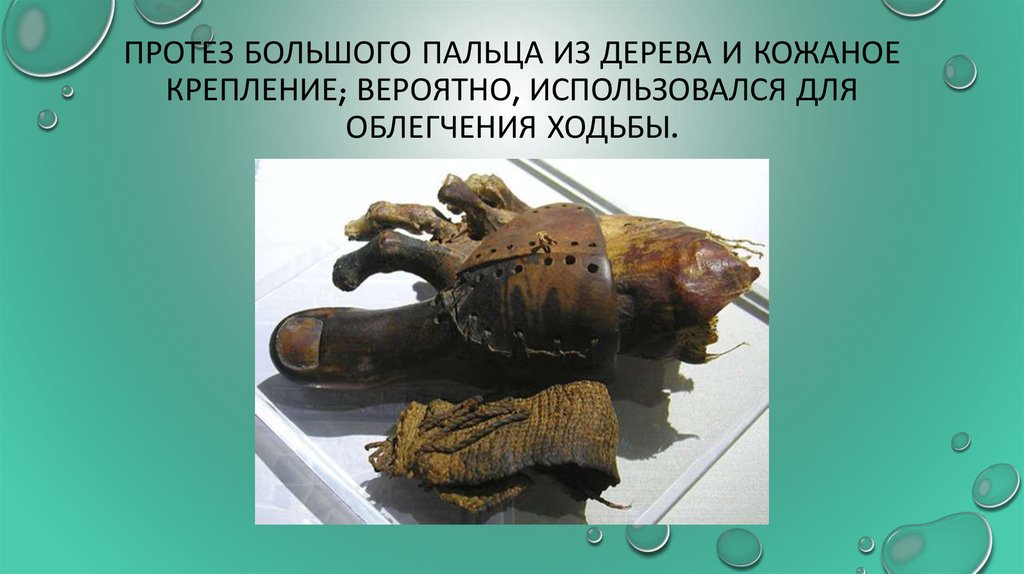 Медицина в Древнем Египте - презентация онлайн