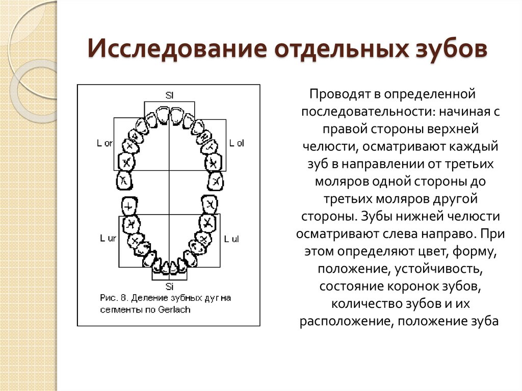 36 зуб на схеме