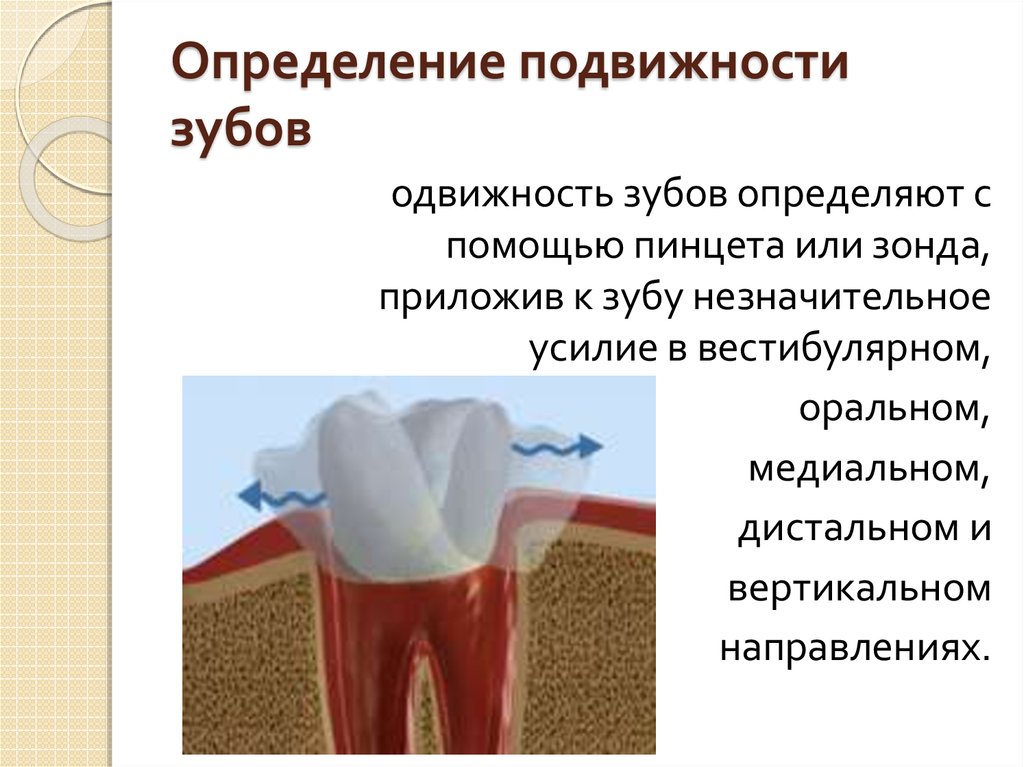 Подвижность это. Подвижность зубов III степени. Степень подвижности зубов определяют. Определение степени подвижности зубов. Патологическая подвижность зубов.