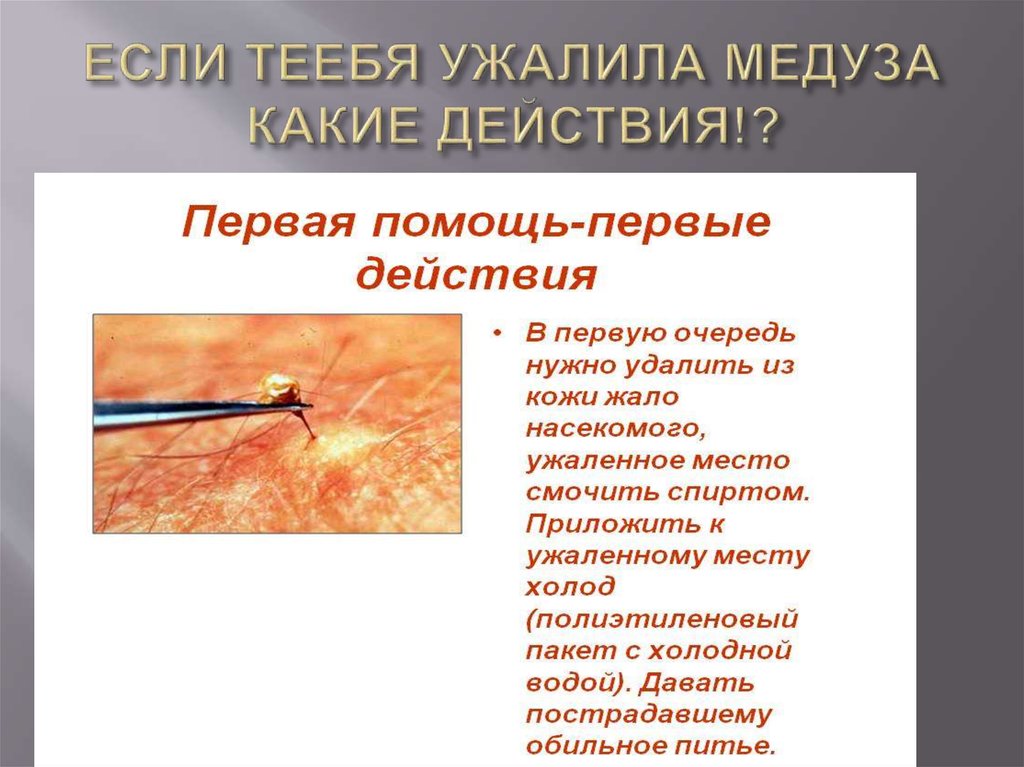 ЕСЛИ ТЕЕБЯ УЖАЛИЛА МЕДУЗА КАКИЕ ДЕЙСТВИЯ!?