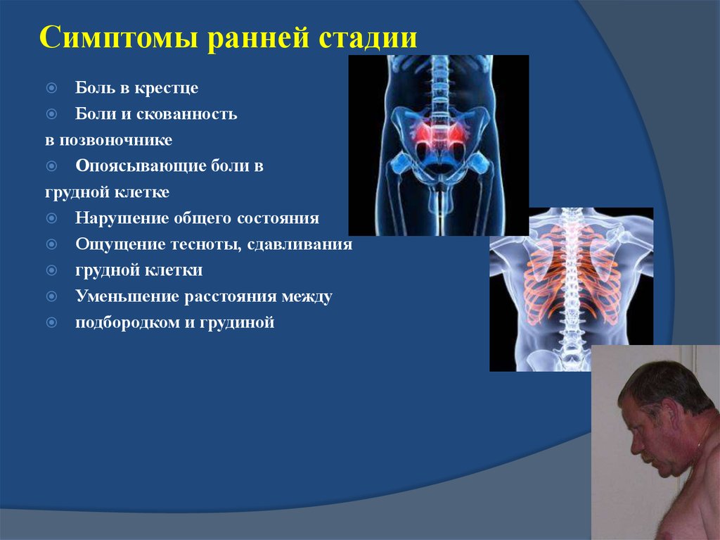 Болезнь фридрейха презентация