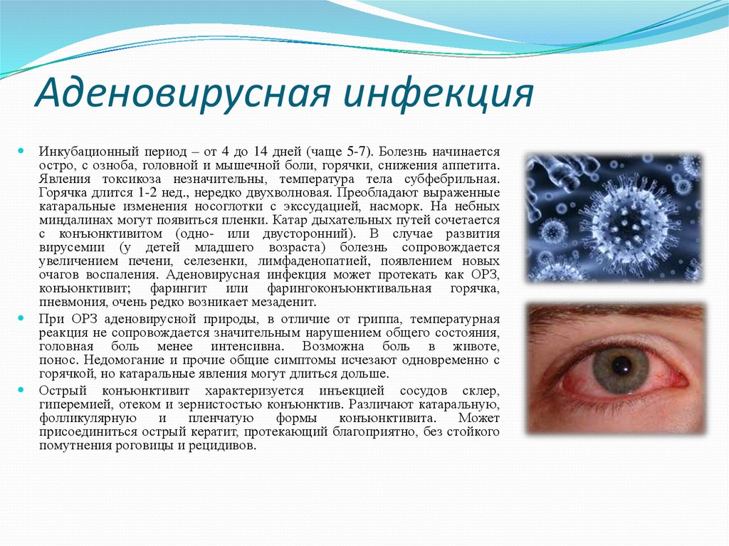 Орви и глаза. Симптомы аденовирусной инфекции:симптомы аденовирусной инфекции. Клинические симптомы при аденовирусной инфекции. Конъюнктивит при аденовирусе. Аденовирусные и вирусные конъюнктивиты.