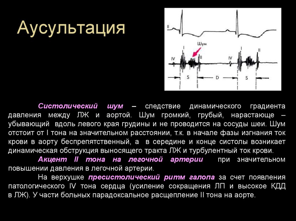 Градиент давления