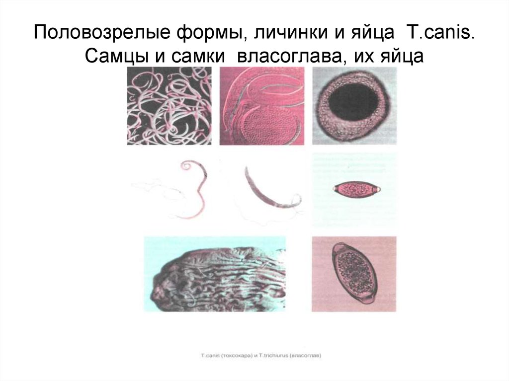 Паразитические черви лабораторная работа. Яйцо власоглава с личинкой. Власоглав половозрелая особь. Половозрелый власоглав. Половозрелая форма власоглава.