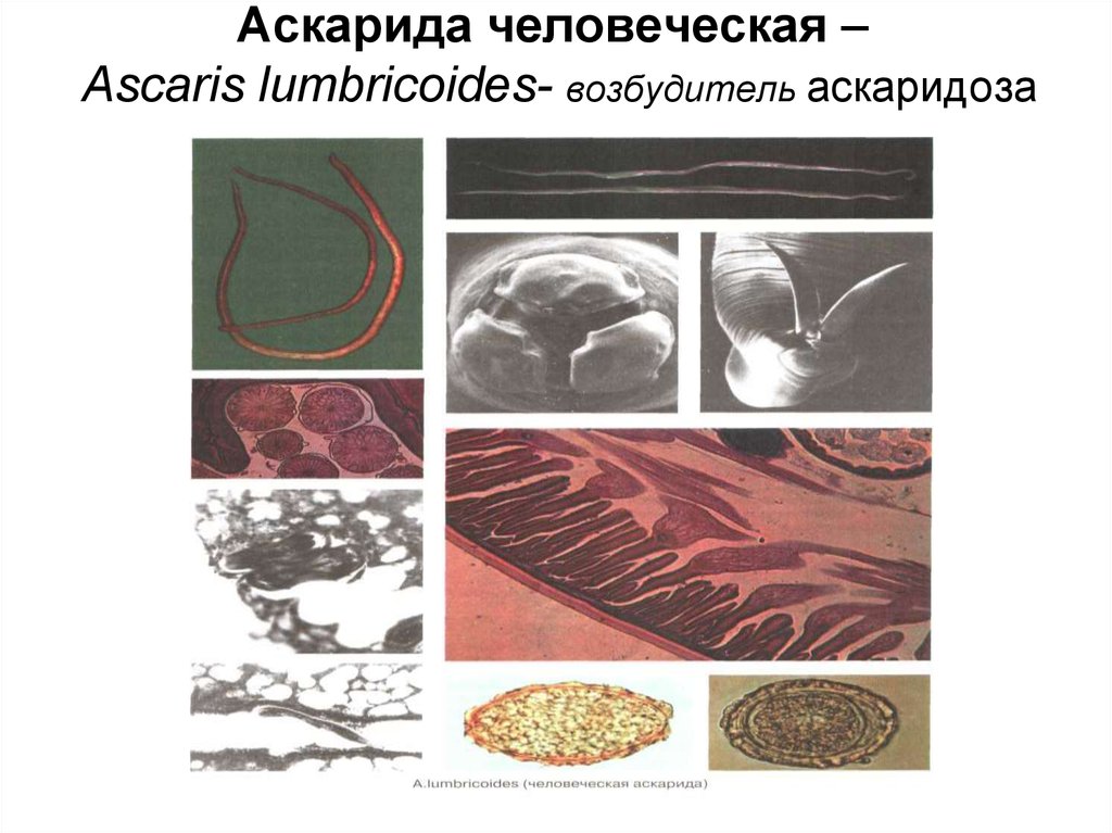 Аскаридоз возбудитель рисунок