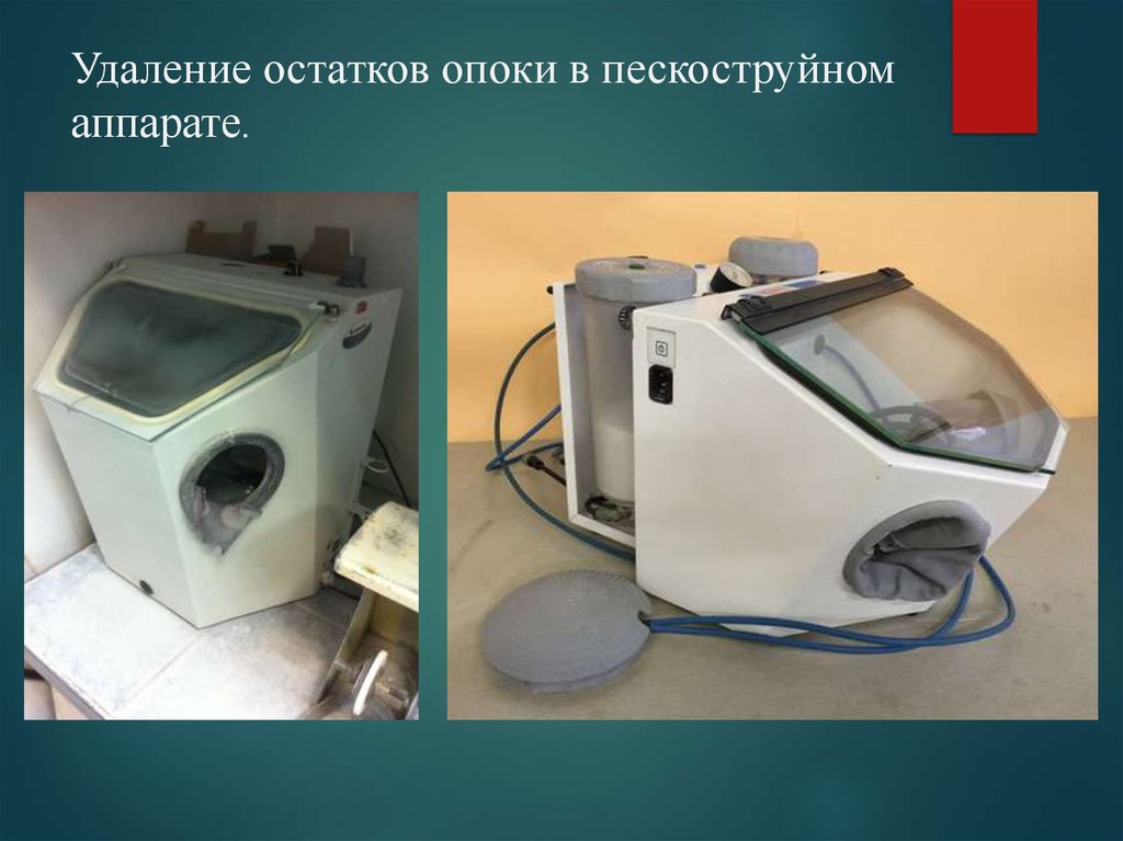 Удаление остатков. Опока в пескоструйном аппарате. Удаление остатков опоки в пескоструйном аппарате. Пескоструй в ортопедической стоматологии. Обработка в пескоструйном аппарате каркаса.