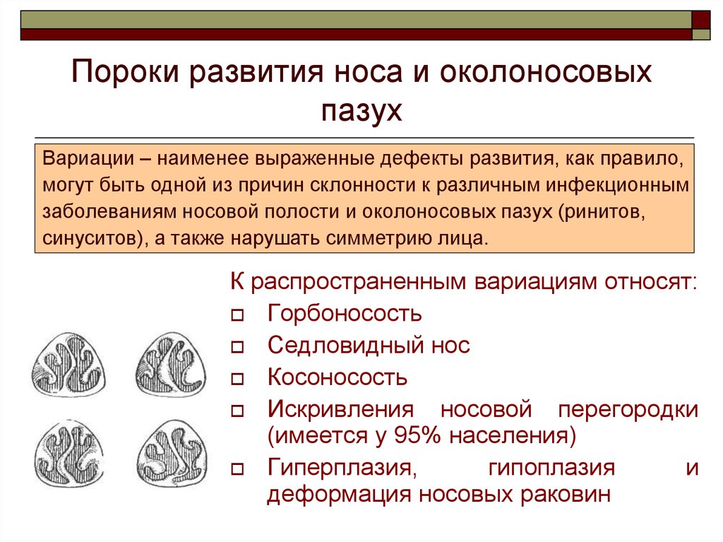 Аномалии развития. Аномалии и пороки развития полости носа. Врожденный порок развития на носу. Анамалии развитие носа. Пороки развития носовой полости.