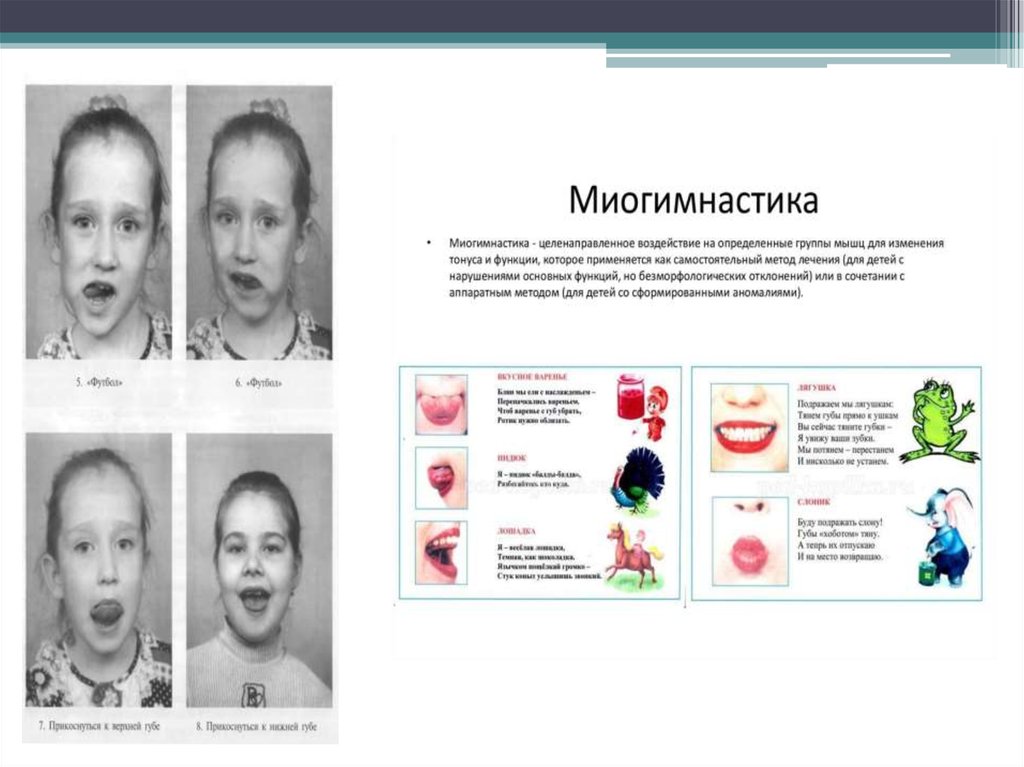 Презентация миогимнастика в ортодонтии - 85 фото