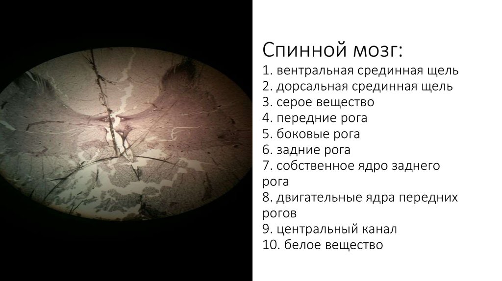 Спинной мозг: 1. вентральная срединная щель 2. дорсальная срединная щель 3. серое вещество 4. передние рога 5. боковые рога 6.
