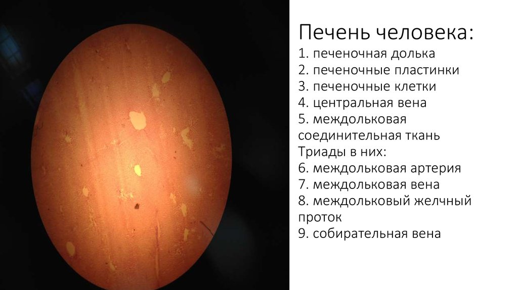 Печень человека: 1. печеночная долька 2. печеночные пластинки 3. печеночные клетки 4. центральная вена 5. междольковая