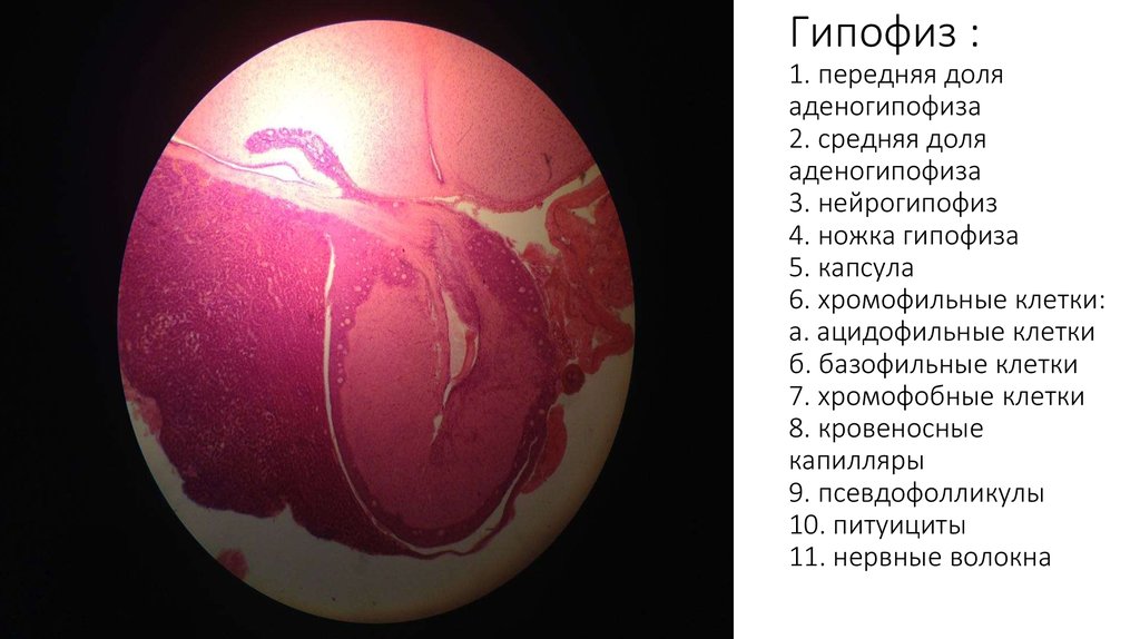 Аденогипофиз рисунок гистология