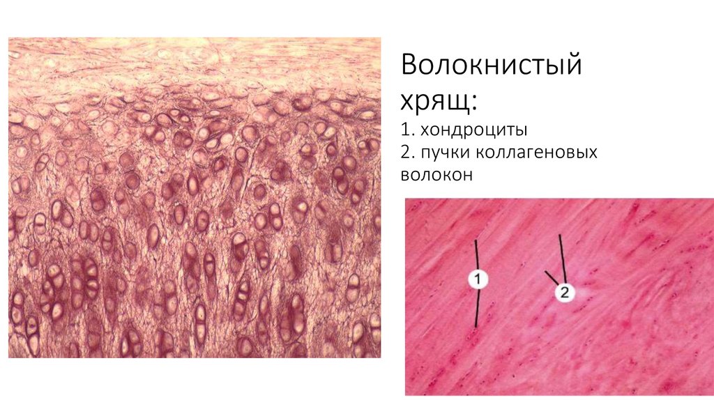 Волокнистый хрящ рисунок