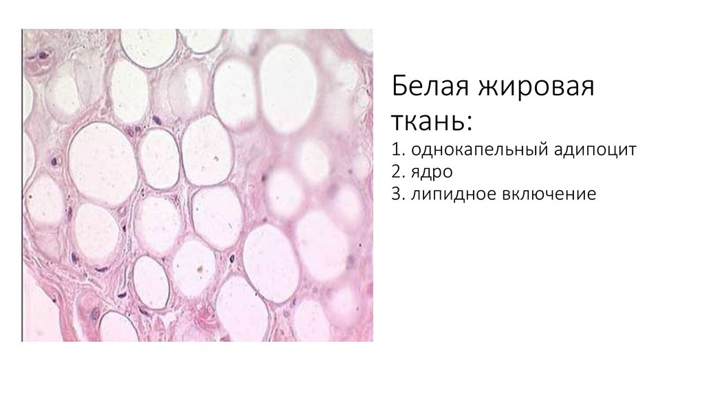 Жировая ткань. Белая жировая ткань гистология препарат. Жировая ткань адипоциты гистология. Жировая ткань сальника препарат. Белая жировая ткань гистология строение.