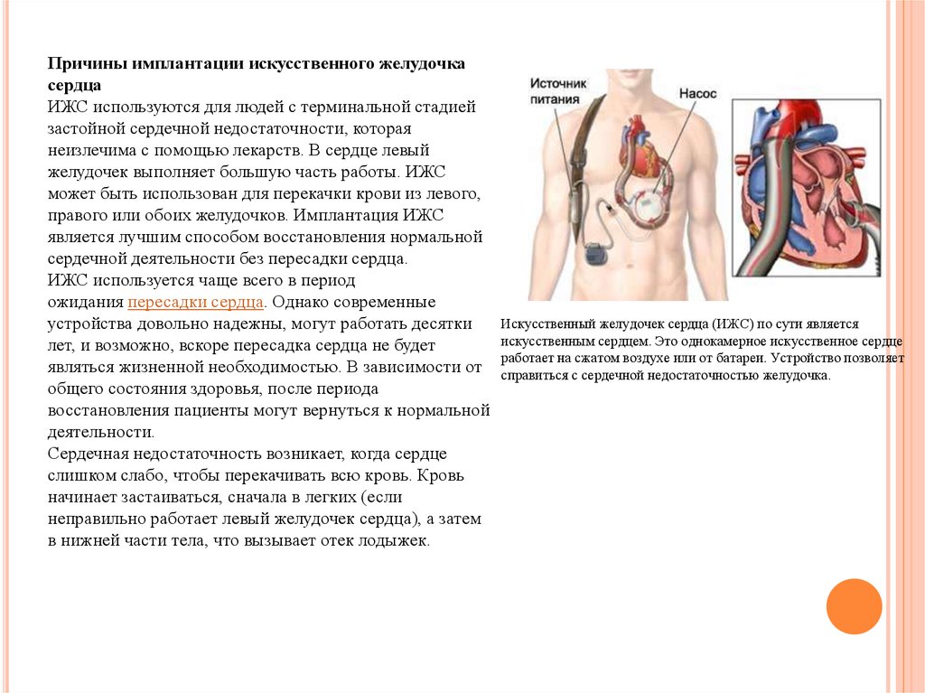 Сколько весит искусственный левый желудочек. Схема искусственного сердца abiocor. Искусственный левый желудочек сердца. Искусственного левого желудочка (LVAD). Искусственный левый желудочек операция.