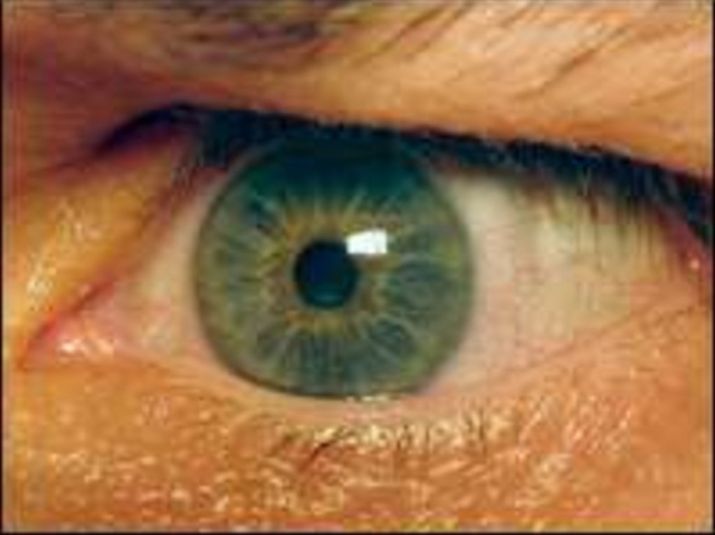 Описание желтых глаз. Пожелтение склер гепатит.